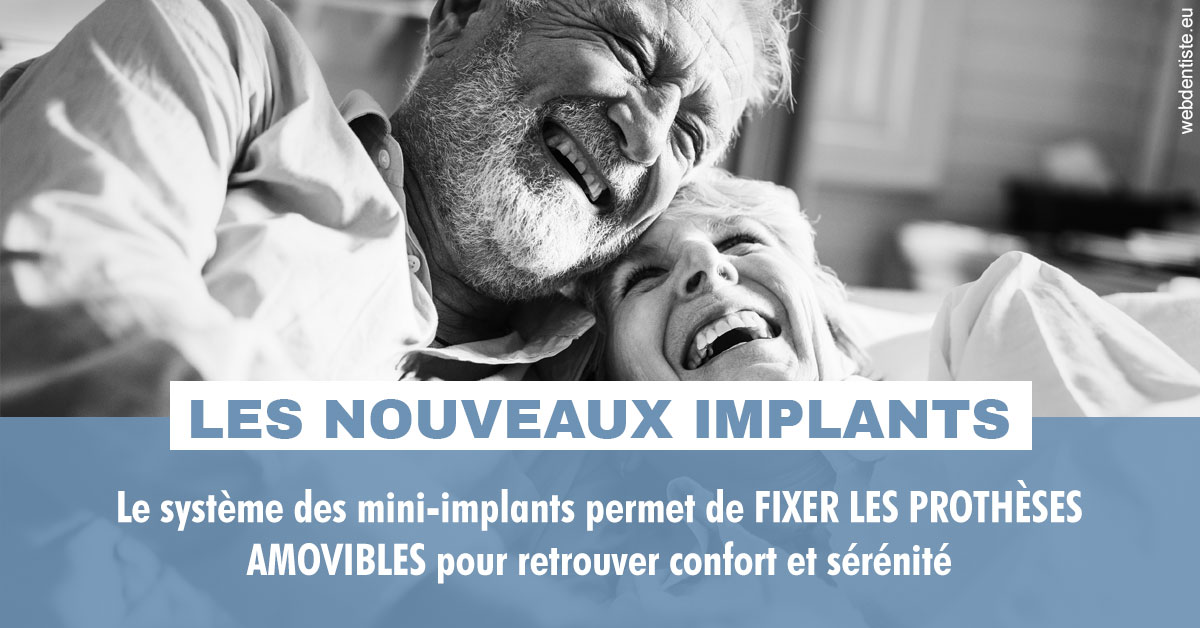 https://dr-charles-graindorge.chirurgiens-dentistes.fr/Les nouveaux implants 2