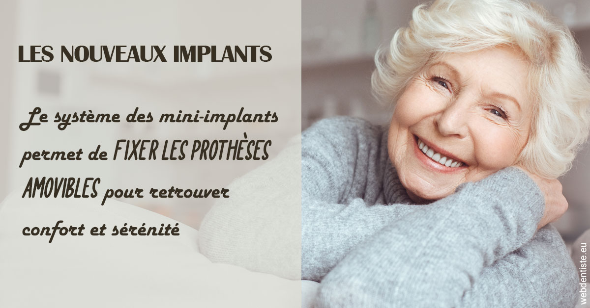 https://dr-charles-graindorge.chirurgiens-dentistes.fr/Les nouveaux implants 1