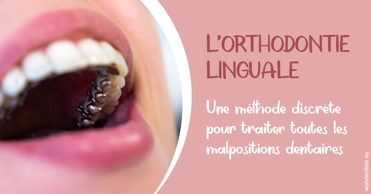 https://dr-charles-graindorge.chirurgiens-dentistes.fr/L'orthodontie linguale 2