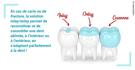 https://dr-charles-graindorge.chirurgiens-dentistes.fr/L'INLAY ou l'ONLAY