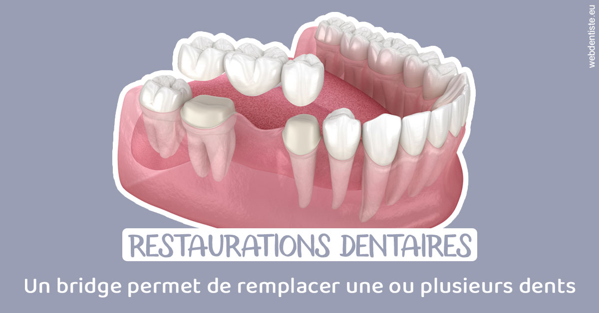 https://dr-charles-graindorge.chirurgiens-dentistes.fr/Bridge remplacer dents 1