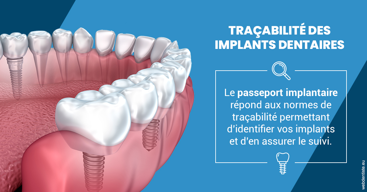 https://dr-charles-graindorge.chirurgiens-dentistes.fr/T2 2023 - Traçabilité des implants 1