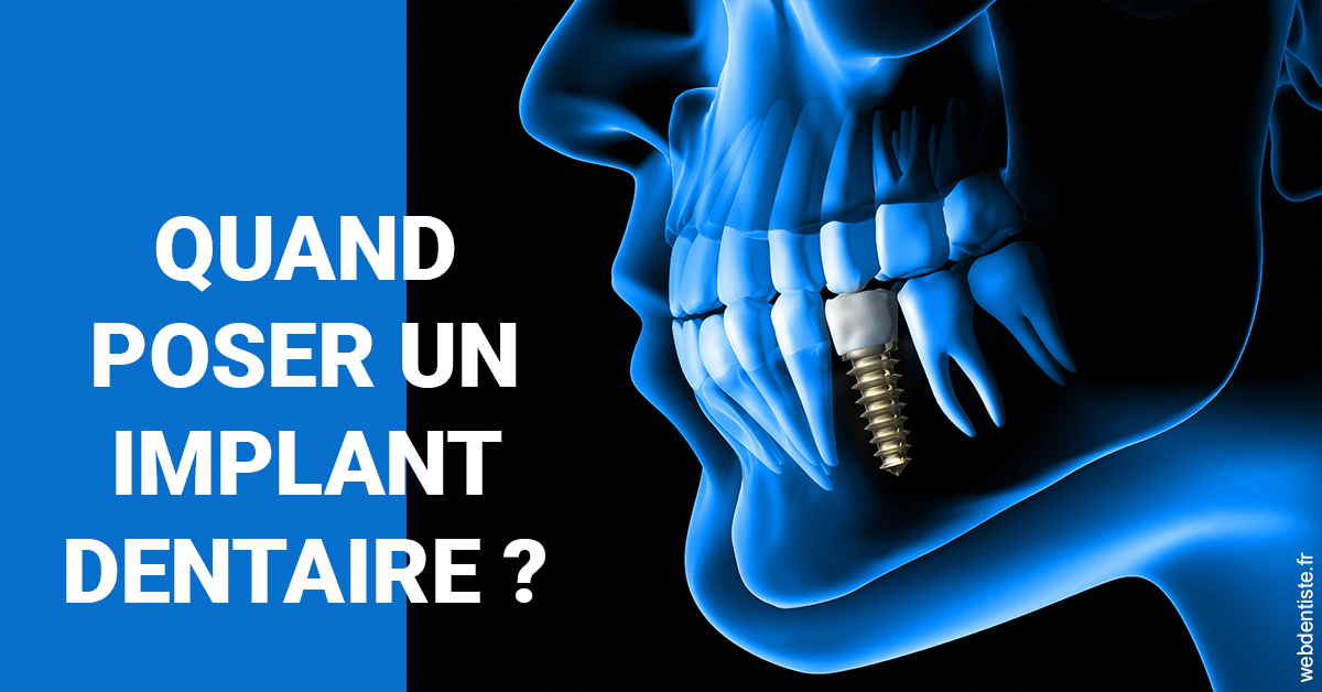 https://dr-charles-graindorge.chirurgiens-dentistes.fr/Les implants 1