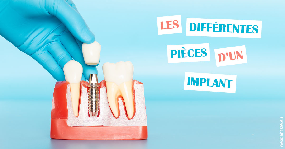 https://dr-charles-graindorge.chirurgiens-dentistes.fr/Les différentes pièces d’un implant 2