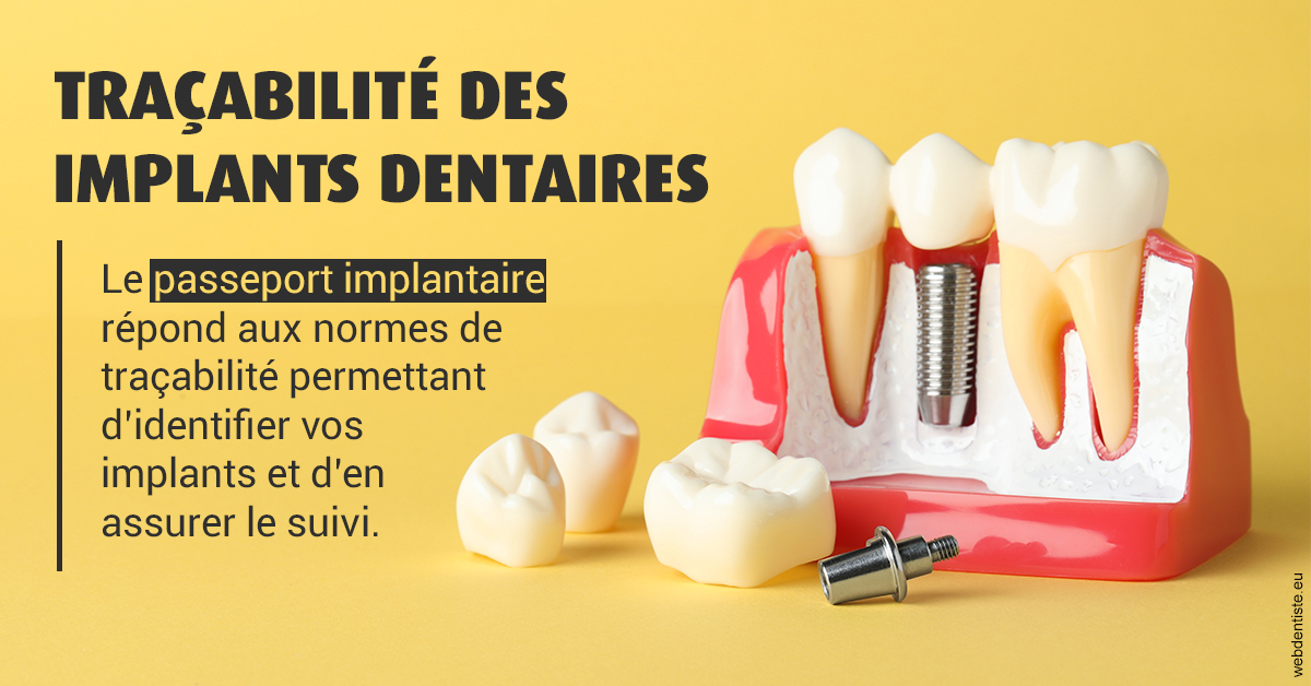 https://dr-charles-graindorge.chirurgiens-dentistes.fr/T2 2023 - Traçabilité des implants 2