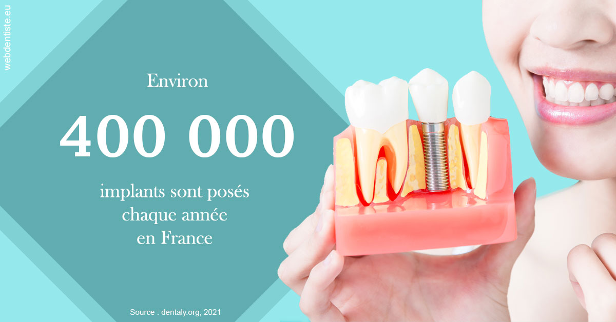 https://dr-charles-graindorge.chirurgiens-dentistes.fr/Pose d'implants en France 2