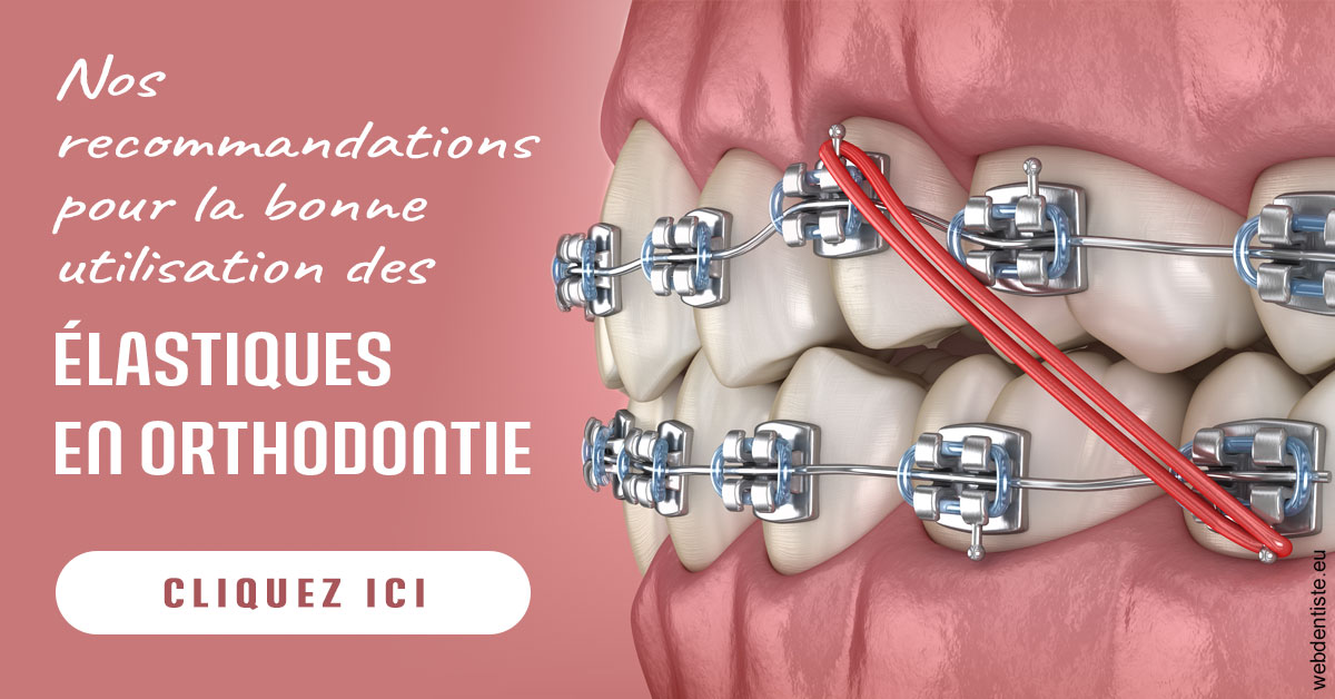 https://dr-charles-graindorge.chirurgiens-dentistes.fr/Elastiques orthodontie 2